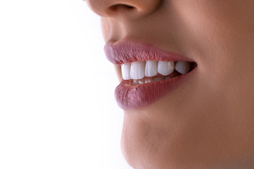 Close-up profile of a bright, healthy smile